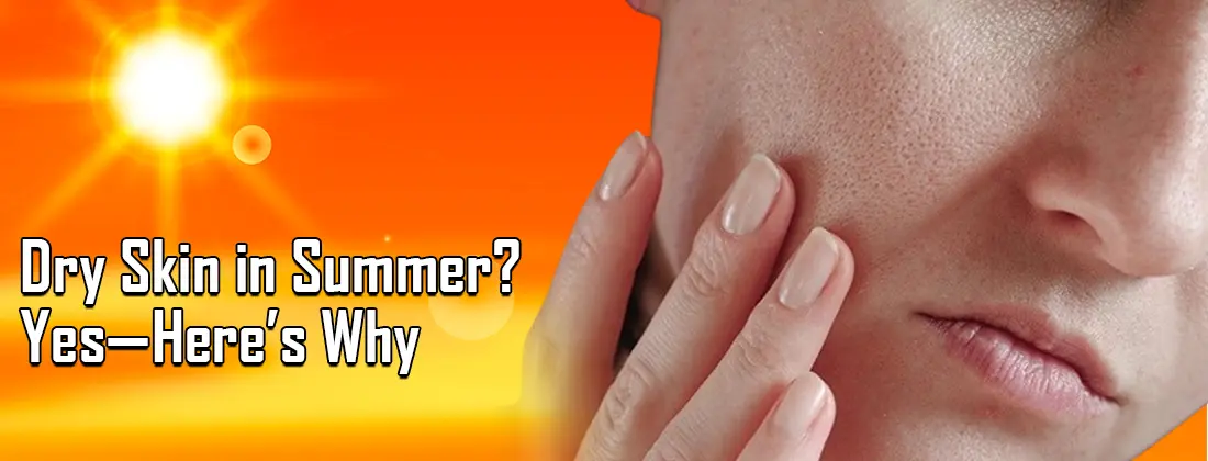 Dry Skin in Summer Yes here is Why